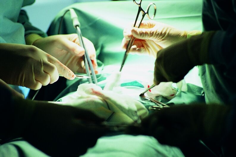 chirurgische Vergrößerung der Penisdicke