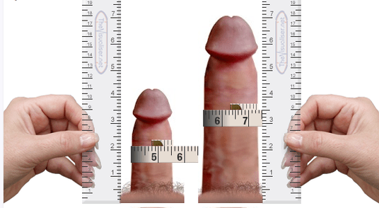 Vergrößerung des Penis